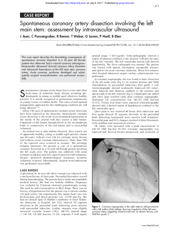 (PDF) Spontaneous coronary artery dissection involving the left main ...
