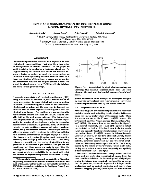 (PDF) Best basis segmentation of ECG signals using novel optimalitycriteria
