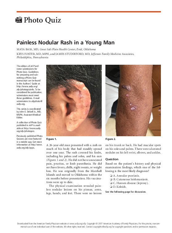 (PDF) Painless Nodular Rash in a Young Man