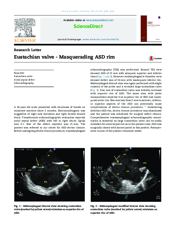(PDF) Eustachian valve - Masquerading ASD rim | Aman Makhija - Academia.edu