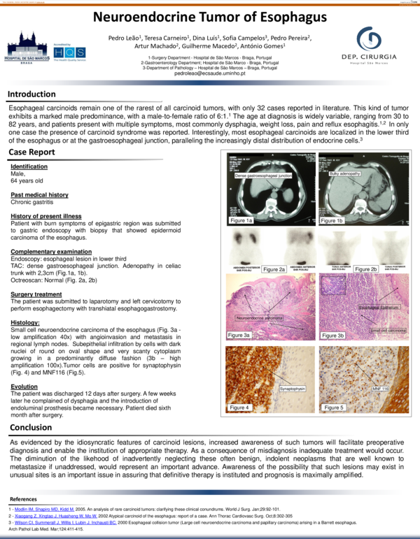 (PDF) Neuroendocrine Tumor of Esophagus António Gomes Academia.edu