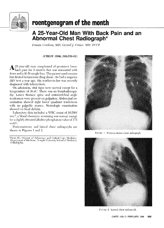 (PDF) A 25YearOld Man With Back Pain and an Abnormal Chest Radiograph