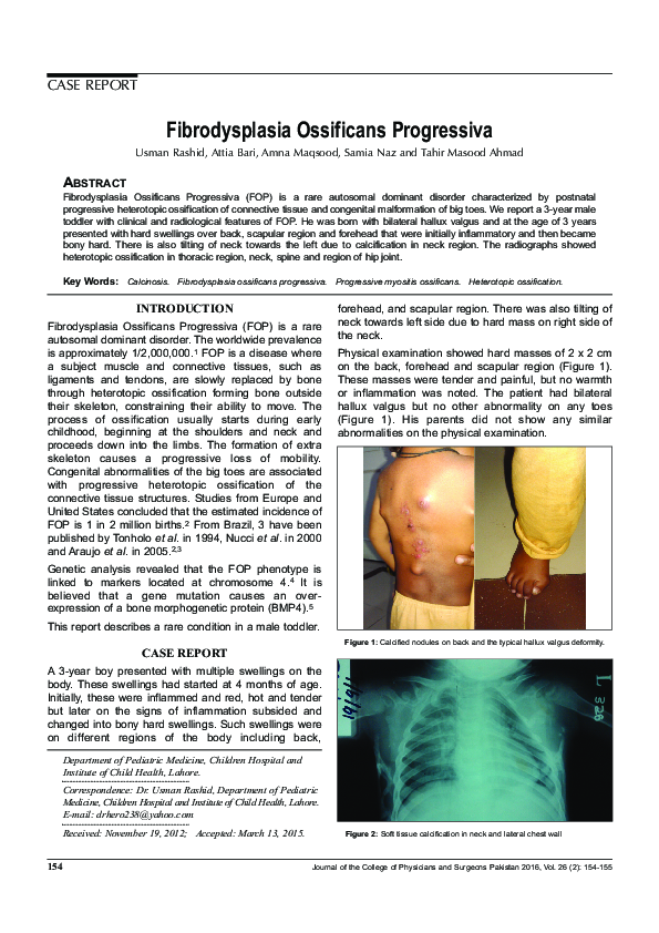 (PDF) Fibrodysplasia Ossificans Progressiva