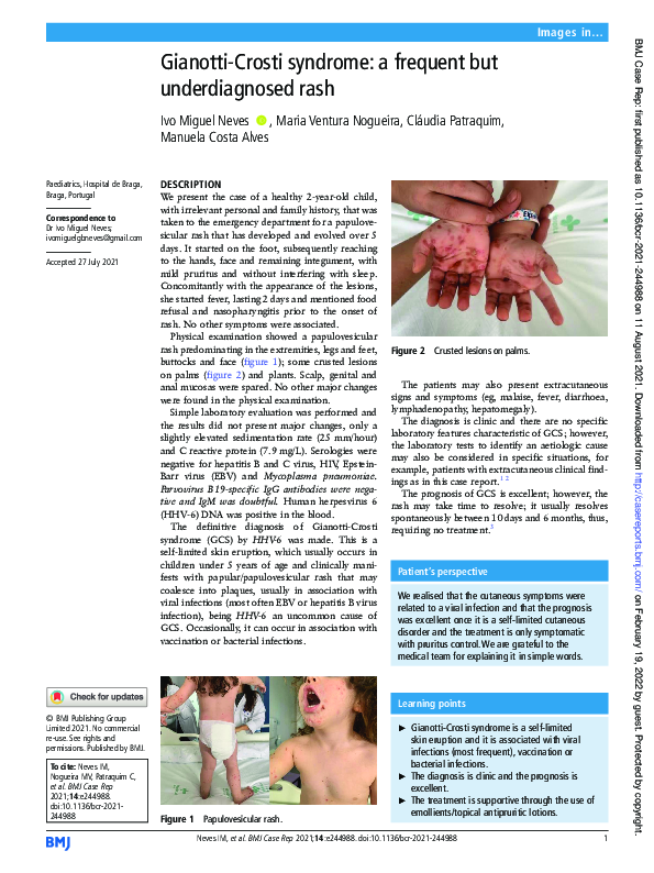 (PDF) Gianotti-Crosti syndrome: a frequent but underdiagnosed rash