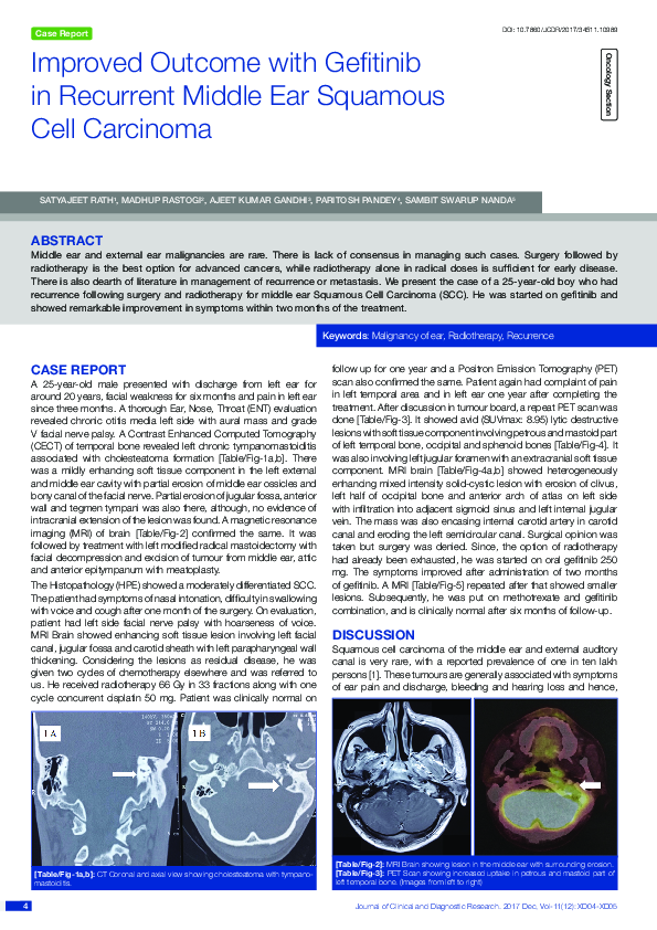 (PDF) Improved Outcome with Gefitinib in Recurrent Middle Ear Squamous ...