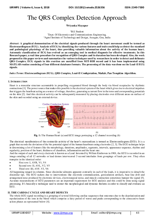 (PDF) The QRS Complex Detection Approach