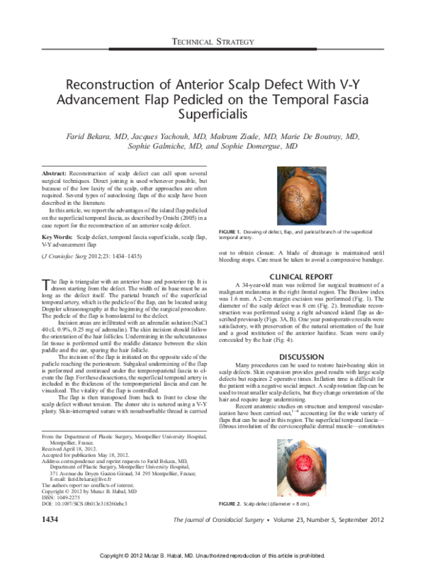 (PDF) Reconstruction of Anterior Scalp Defect With VY Advancement Flap