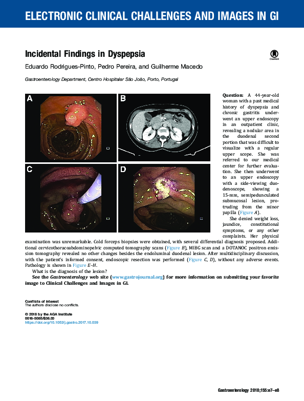 (PDF) Incidental findings in dyspepsia