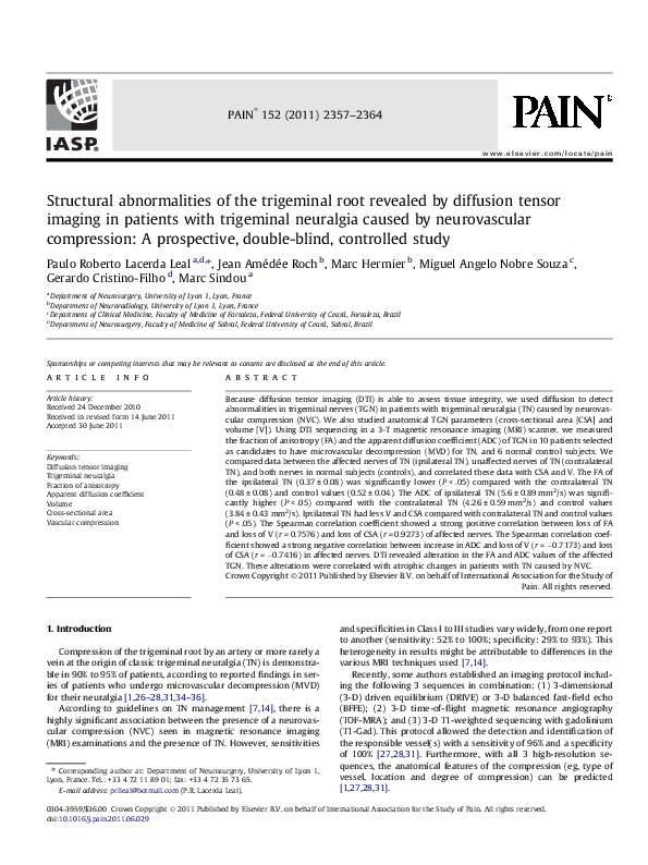 (PDF) Structural abnormalities of the trigeminal root revealed by ...