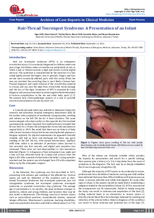 (PDF) HairThread Tourniquet Syndrome A Presentation of an Infant hasan büyükaslan Academia.edu