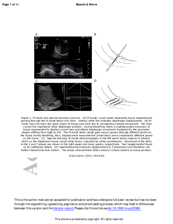 (PDF) Speckle tracking as a method to measure hemidiaphragm excursion