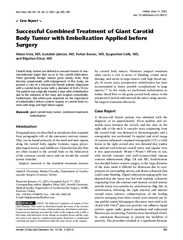 (PDF) Successful Combined Treatment of Giant Carotid Body Tumor with ...