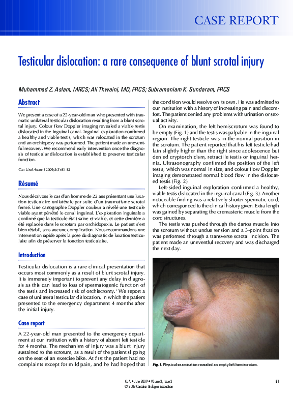 (PDF) Testicular dislocation: a rare consequence of blunt scrotal injury