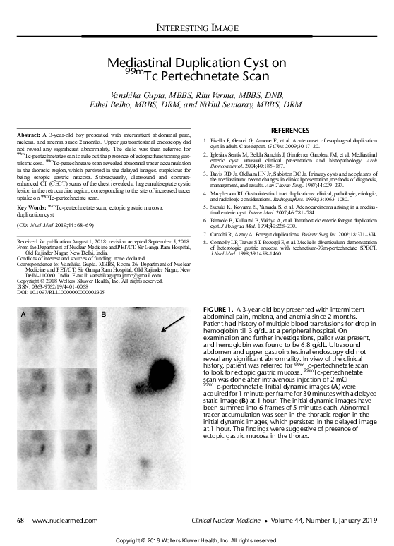 (PDF) Mediastinal Duplication Cyst on 99mTc Pertechnetate Scan