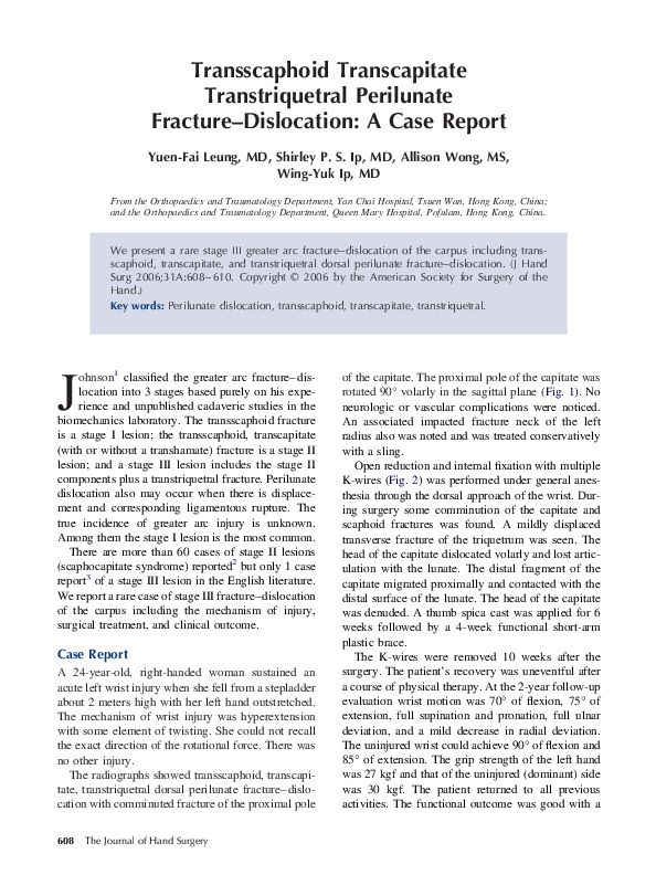 (PDF) Transscaphoid Transcapitate Transtriquetral Perilunate Fracture ...
