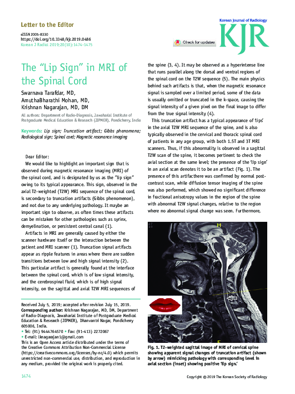 (PDF) The “Lip Sign” in MRI of the Spinal Cord