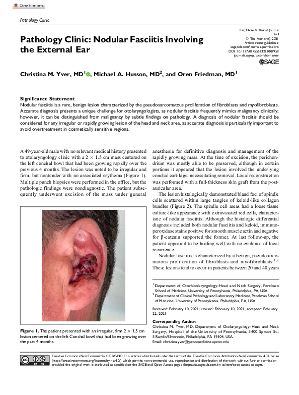 (PDF) Pathology Clinic: Nodular Fasciitis Involving the External Ear