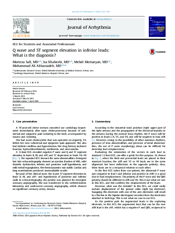 (PDF) Q wave and ST segment elevation in inferior leads: What is the ...