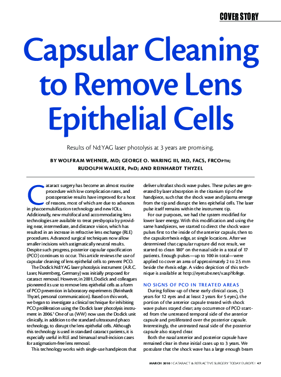 (PDF) Capsular Cleaning to Remove Lens Epithelial Cells