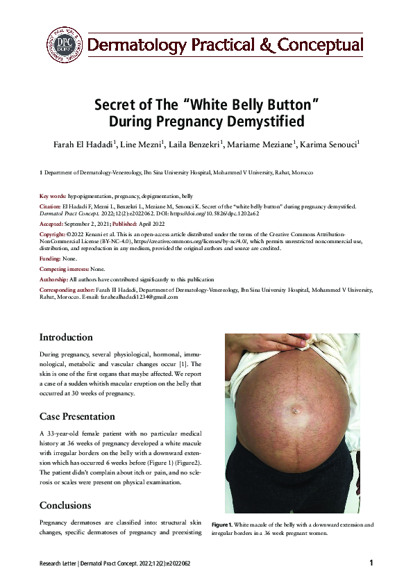 (PDF) Secret of the" white belly button" during pregnancy demystified