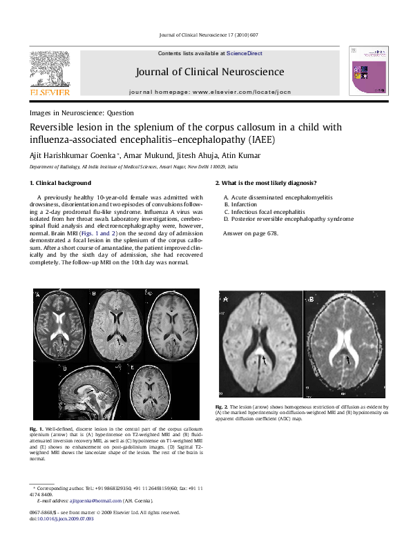 (PDF) Reversible lesion in the splenium of the corpus callosum in a ...