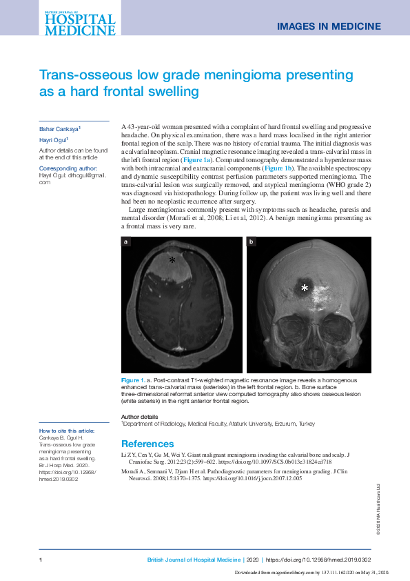 (PDF) Trans-osseous low grade meningioma presenting as a hard frontal ...