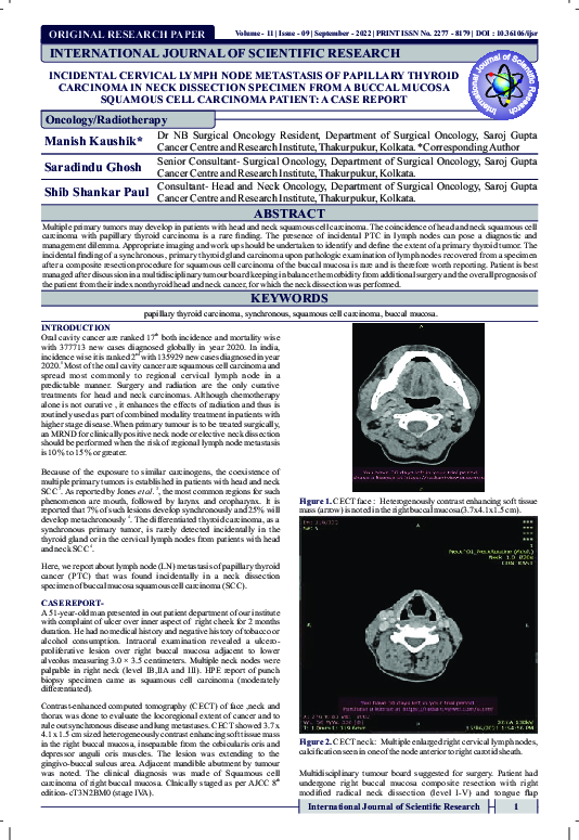 (PDF) INCIDENTAL CERVICAL LYMPH NODE METASTASIS OF PAPILLARY THYROID ...
