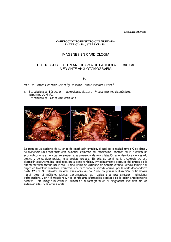 (PDF) Diagnóstico De Un Aneurisma De La Aorta Torácica Mediante ...