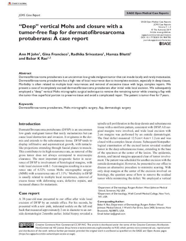 (PDF) “Deep” vertical Mohs and closure with a tumor-free flap for ...