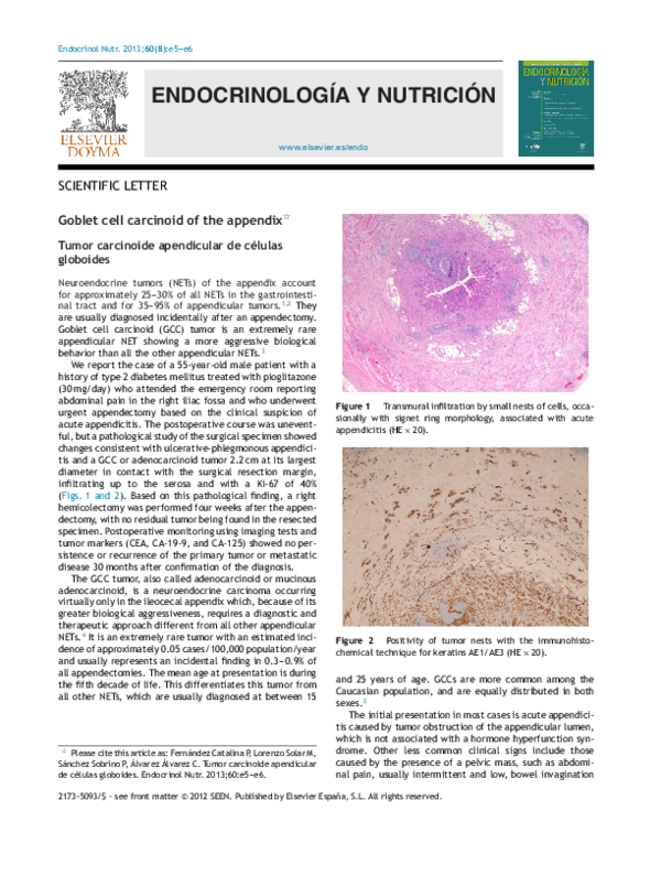 (PDF) Goblet cell carcinoid of the appendix
