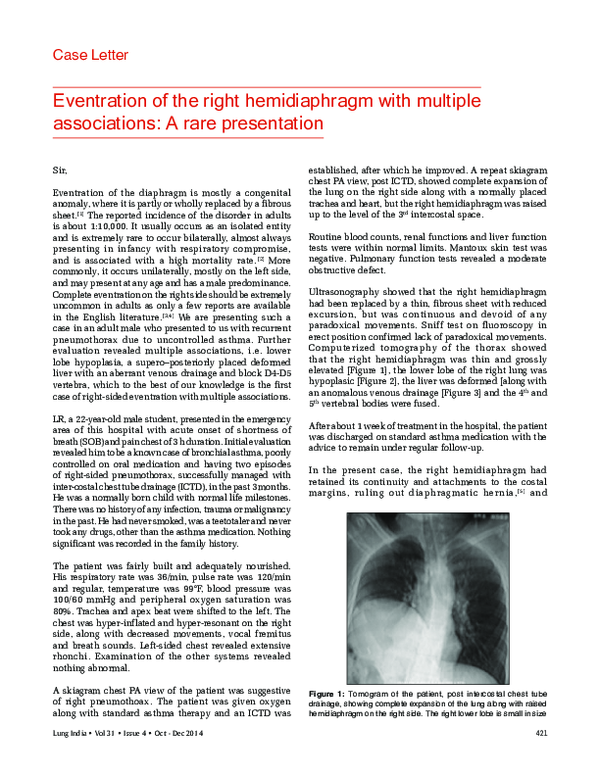 (PDF) Eventration of the right hemidiaphragm with multiple associations ...