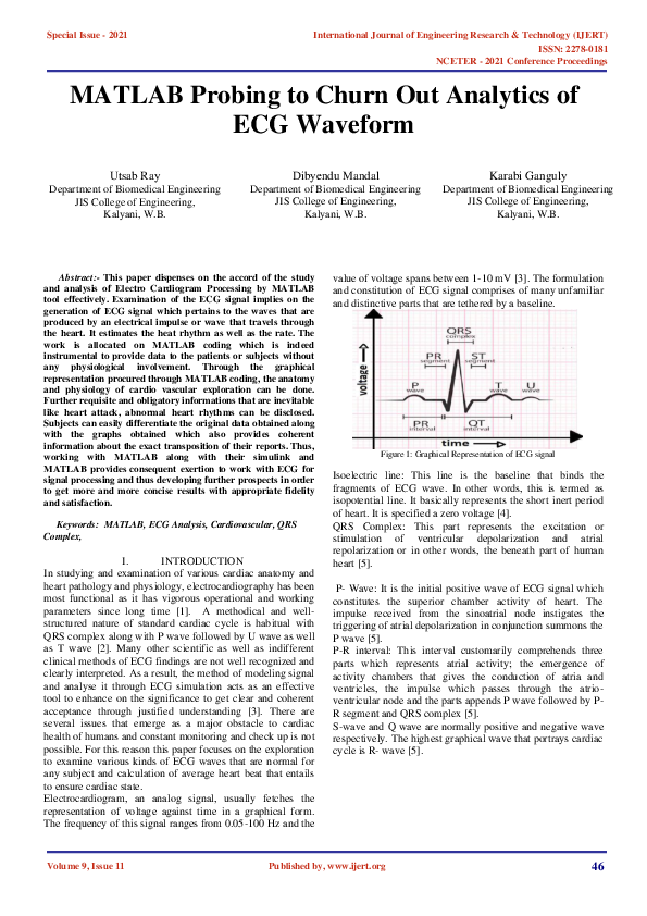 (PDF) MATLAB Probing to Churn Out Analytics of ECG Waveform
