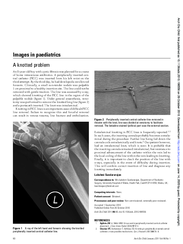 (PDF) A knotted problem