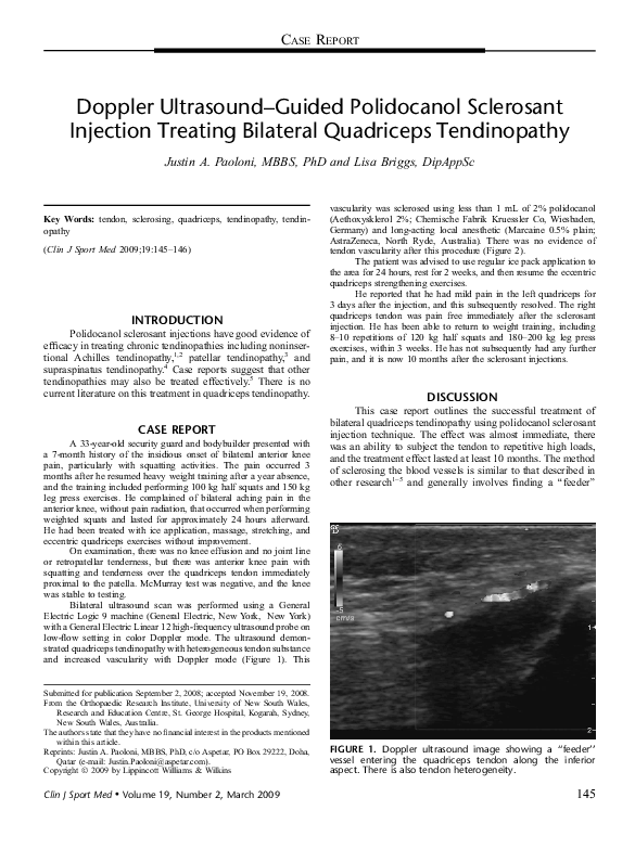 (PDF) Doppler UltrasoundGuided Polidocanol Sclerosant Injection