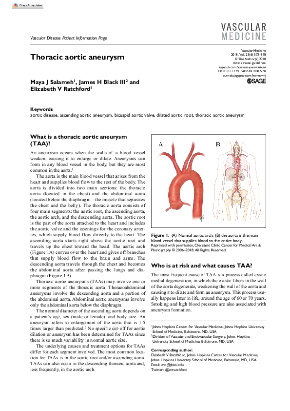 (PDF) Thoracic aortic aneurysm | James Black - Academia.edu