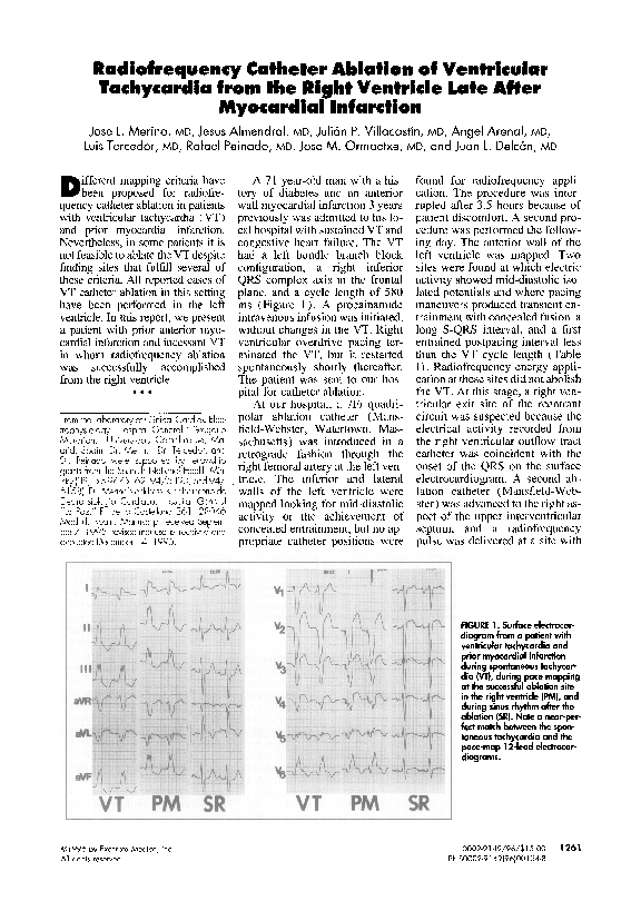 (PDF) Radiofrequency catheter ablation of ventricular tachycardia from ...