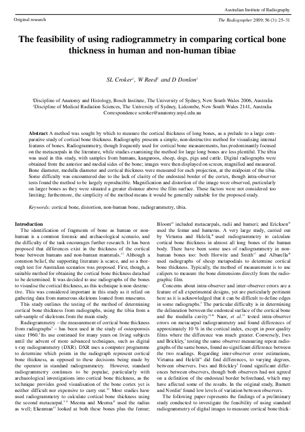 (PDF) The feasibility of using radiogrammetry in comparing cortical ...