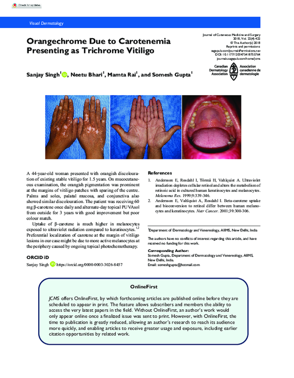 (PDF) Orangechrome Due to Carotenemia Presenting as Trichrome Vitiligo