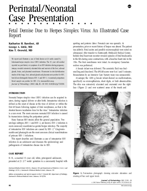 (PDF) Fetal Demise Due to Herpes Simplex Virus An Illustrated Case