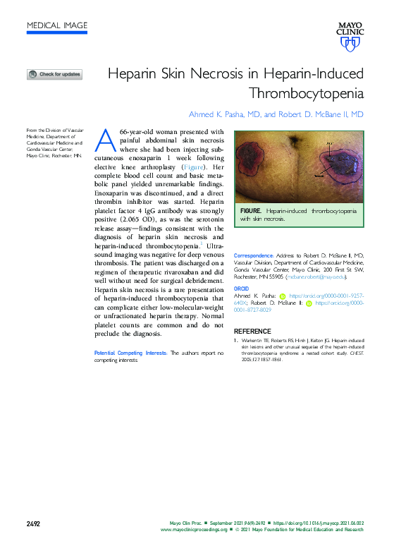 (PDF) Heparin Skin Necrosis in Heparin-Induced Thrombocytopenia