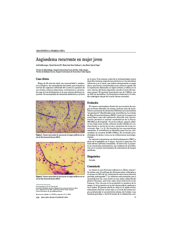 (PDF) Angioedema recurrente en mujer joven | ANA KARINA BARRAGAN TAPIA ...