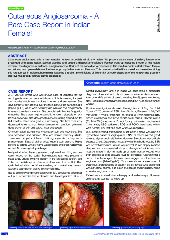 (PDF) Cutaneous Angiosarcoma - A Rare Case Report in Indian Female!