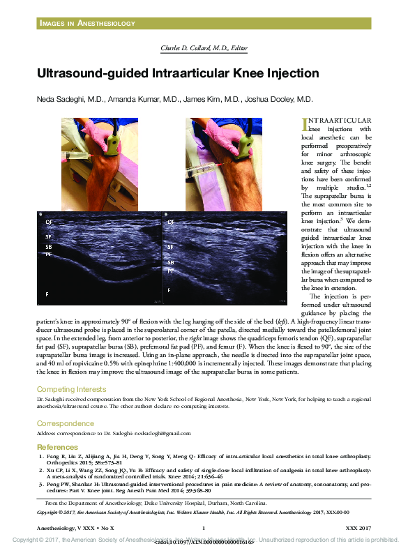 (PDF) Ultrasound-guided Intraarticular Knee Injection