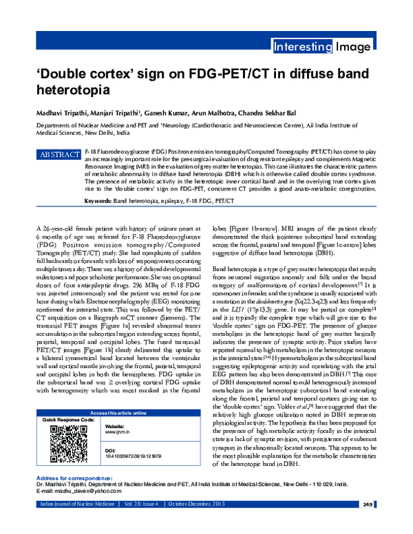 (PDF) ′Double cortex′ sign on FDG-PET/CT in diffuse band heterotopia