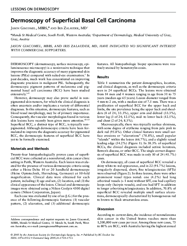 (PDF) Dermoscopy of Superficial Basal Cell Carcinoma