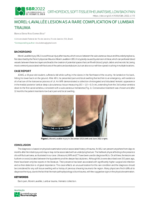 (PDF) MorelLavallée Lesion as a Rare Complication of Lumbar Trauma