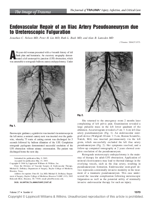(PDF) Endovascular Repair of an Iliac Artery Pseudoaneurysm due to ...
