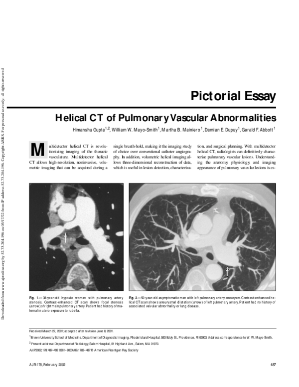 (PDF) Helical CT of Pulmonary Vascular Abnormalities