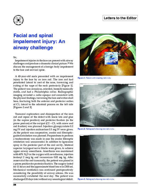 (PDF) Facial and spinal impalement injury: An airway challenge