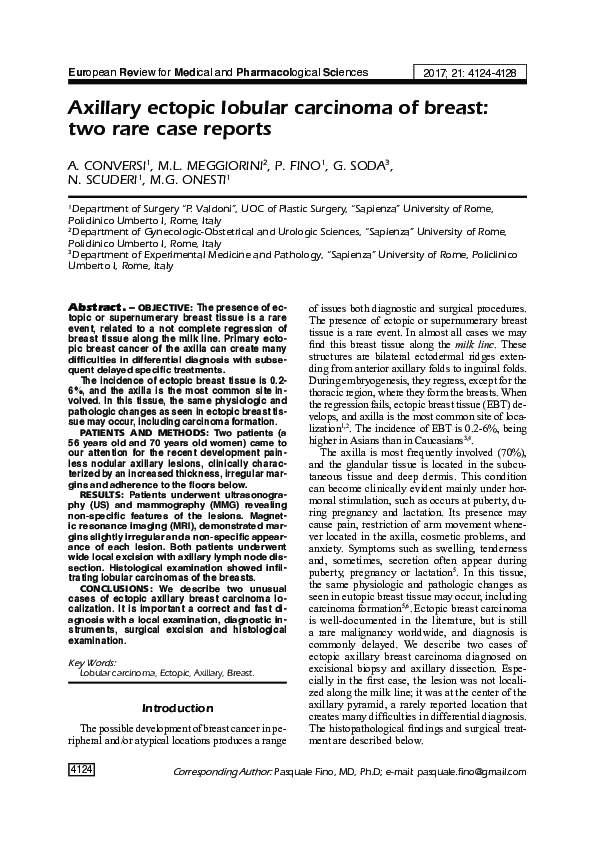 (PDF) Ectopic Lobular Carcinoma in Axillary Breast Tissue: Case Series